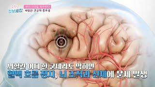 한 번 손상되면 재생 불가인 ‘뇌혈관 질환들’ TV CHOSUN 210819 방송  | [굿모닝 정보세상] 470회 | TV조선