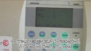 OSCE-1.НМУ ім.О.О.Богомольця.Методика реєстрації ЕКГ (офіційна версія)