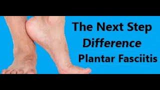 The Next Step Difference:  Plantar Fasciitis