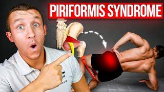 Piriformis Syndrome Relief: 4-Step Diagnosis & Top 5 Exercises + Live Case Study