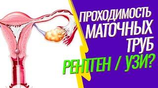 ГИСТЕРОСАЛЬПИНГОГРАФИЯ (ГСГ маточных труб)  Проверить проходимость труб