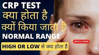 CRP test kya hota hai | crp test in hindi | crp test normal range | crp high hone se kya hota hai