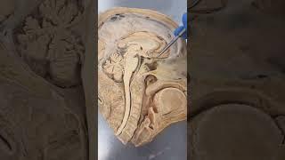 REAL Human Pituitary Gland