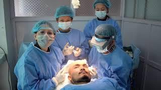 DIRECT HAIR TRANSPLANT