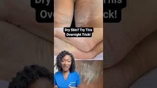 Dry Skin? Try This Overnight Trick! Slugging Explained #ad