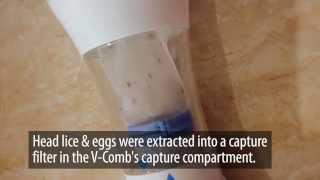 How to combat Head lice using LiceTec V-Comb