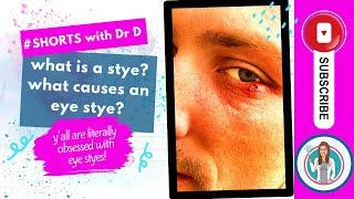 What is a Stye? What Causes an Eye Stye? What triggers an eye stye? #youtubeshorts #shortsyoutube