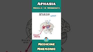 Broca's Aphasia VS Wernicke's Aphasia : mnemonic | #shorts