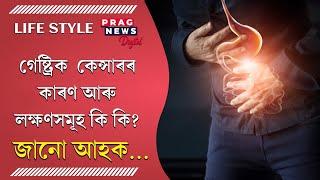 Gastric Cancer: Know the causes and symptoms of this disease