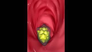 Digestive system-  swallowing food (3D Animation)