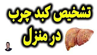 تشخیص کبد چرب در منزل 