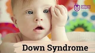 Down Syndrome in Kids || Dr. Rohit Kiran || Ankura Hospital Vijayawada & Tirupati