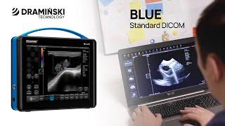 Tele-ultrasound. DICOM compatible files. How does it work? DRAMIŃSKI BLUE ultrasound scanner (en)