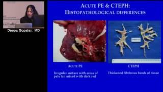 Multimodality Imaging of Chronic Thromboembolic Pulmonary Hypertension (Deepa Gopalan, MD) 6/23/16