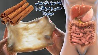 دارچین و ادویه جات بخورید اما نه اینارو !! نکات مهمی که در مورد ان ها باید بدانید!