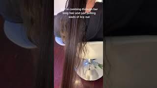 Hairdresser shares video of hair lice INFESTATION on child with 'more lice than strands of hair'