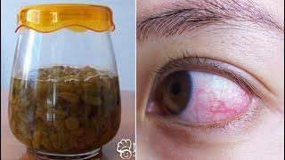 Drink This To Improve Your Eyesight Fast! Heal Your Eyesight Naturally (100% Guaranteed)