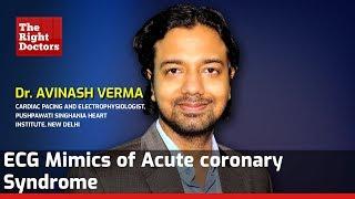 ECG Mimics of Acute Coronary Syndrome | Dr. Avinash Verma | TheRightDoctors