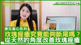 玫瑰痤瘡究竟能夠斷尾嗎？ 從天然的角度改善玫瑰痤瘡 鄭丹瑞《健康旦》註冊中醫師 #楊明霞 EP 14 Part 2 (CC中文字幕)