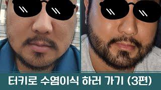 터키 수염이식 | 모발이식 하러가기 (3편)