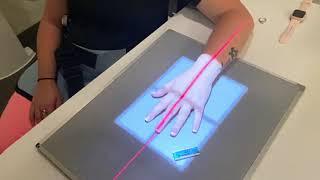 Hand X-Ray Positioning Video