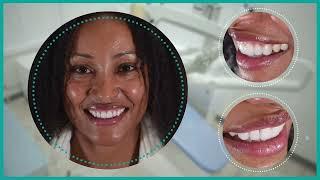 Anna da Firenze | Faccette ed estetica dentale (Your perfect smile)