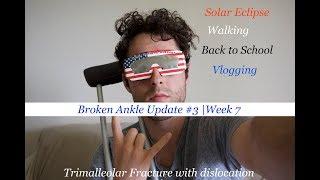 Broken ANKLE Update #3| Walking, Solar ECLIPSE, School & More