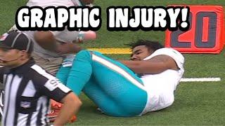 Jaylen Waddle LEG INJURY  Dolphins Vs Texans 2024