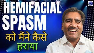 Hemifacial spasm. Treatment by MVD surgery at Pune. Dr Jaydev Panchwagh