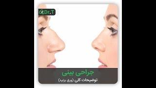 نحوه عمل بینی - انیمیشن