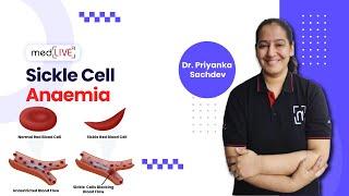 Sickle Cell Anaemia | Pathogenesis | Factors | Diagnosis by DR. Priyanka Sachdev | MedLive