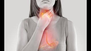 Managing GERD and Acid Reflux with Cancer