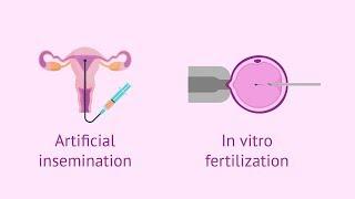 Assisted Reproductive Technology