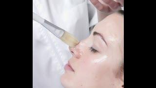 Glycolic Acid [DermTV.com Epi #455]