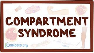 Compartment syndrome - an Osmosis Preview