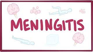 Meningitis - causes, symptoms, diagnosis, treatment, pathology