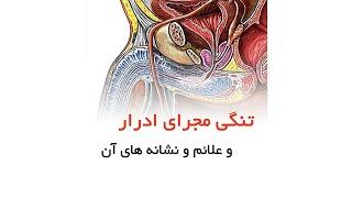 تنگی مجرای ادرار و علائم و نشانه های آن _ دکتر میرصادقی