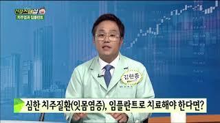 [서울탑치과병원] 건강스페셜 - 임플란트 수명
