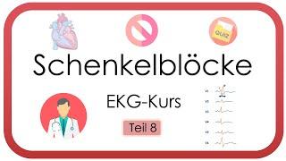 Schenkelblöcke (Links & Rechtsschenkelblock, Linksanteriorer Hemiblock) - EKG Kurs