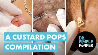 A Custard Pops Compilation 