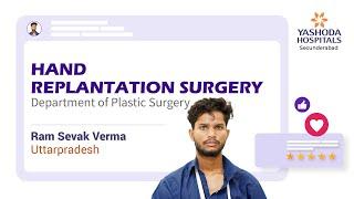 Hand Replantation Surgery | Yashoda Hospitals Hyderabad