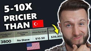 40k Hair Transplant in the USA! Rip Off or Worth It!?