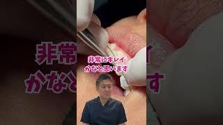 We also offer invisible front orthodontics  #dentist #orthodontics #Kamata #dentist #orthodontics