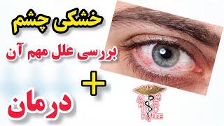 خشکی چشم باعث وجود احساس سنگ ریزه در چشم میشه!