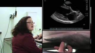 IMV imaging cardiac ultrasound video 4 - Right parasternal long axis 4 chamber view