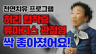 허리 협착증, 류마티스 관절염 천연치유 프로그램으로 싹 좋아졌어요!