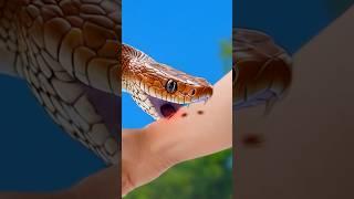 When a Snake Bites You