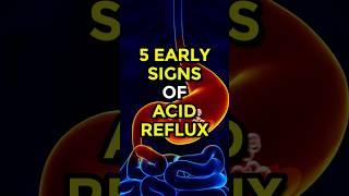 5 Early Signs of Acid Reflux #acidrefluxsymptoms #acidity #ytshorts #ytshortsindia