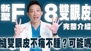 縫雙眼皮會痛嗎？新聖F8雙眼皮完整解說！腫幾天？無痕雙眼皮？維持多久？加碼術後立即訪談心得｜新聖整形外科 林子宇醫師