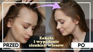 Jak zagęściłam ZAKOLA ? Cienkie włosy i wypadanie włosów po ciąży... mój sposób na ten problem!